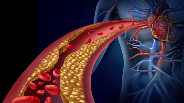 Concepto de hipertensión arterial en el adulto mayor